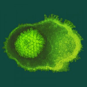 herpes-zoster-varicella