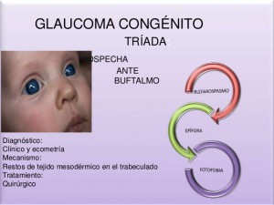 glaucoma-presentacin-7-638