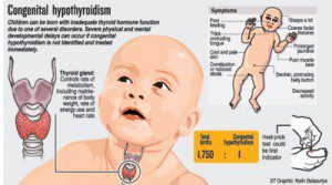 congenital-hypothyroidism-300x167