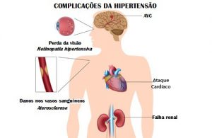 hipertensao-500x325