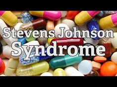 Resultado de imagem para síndrome de stevens johnson