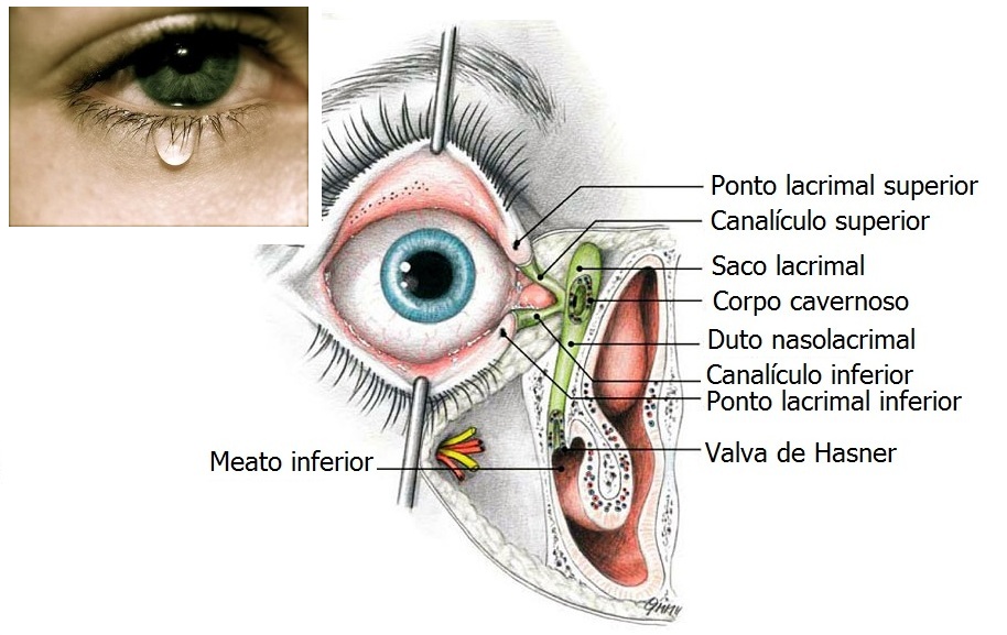 Obstrução do canal lacrimal Fernando Bragança Pediatria e Homeopatia
